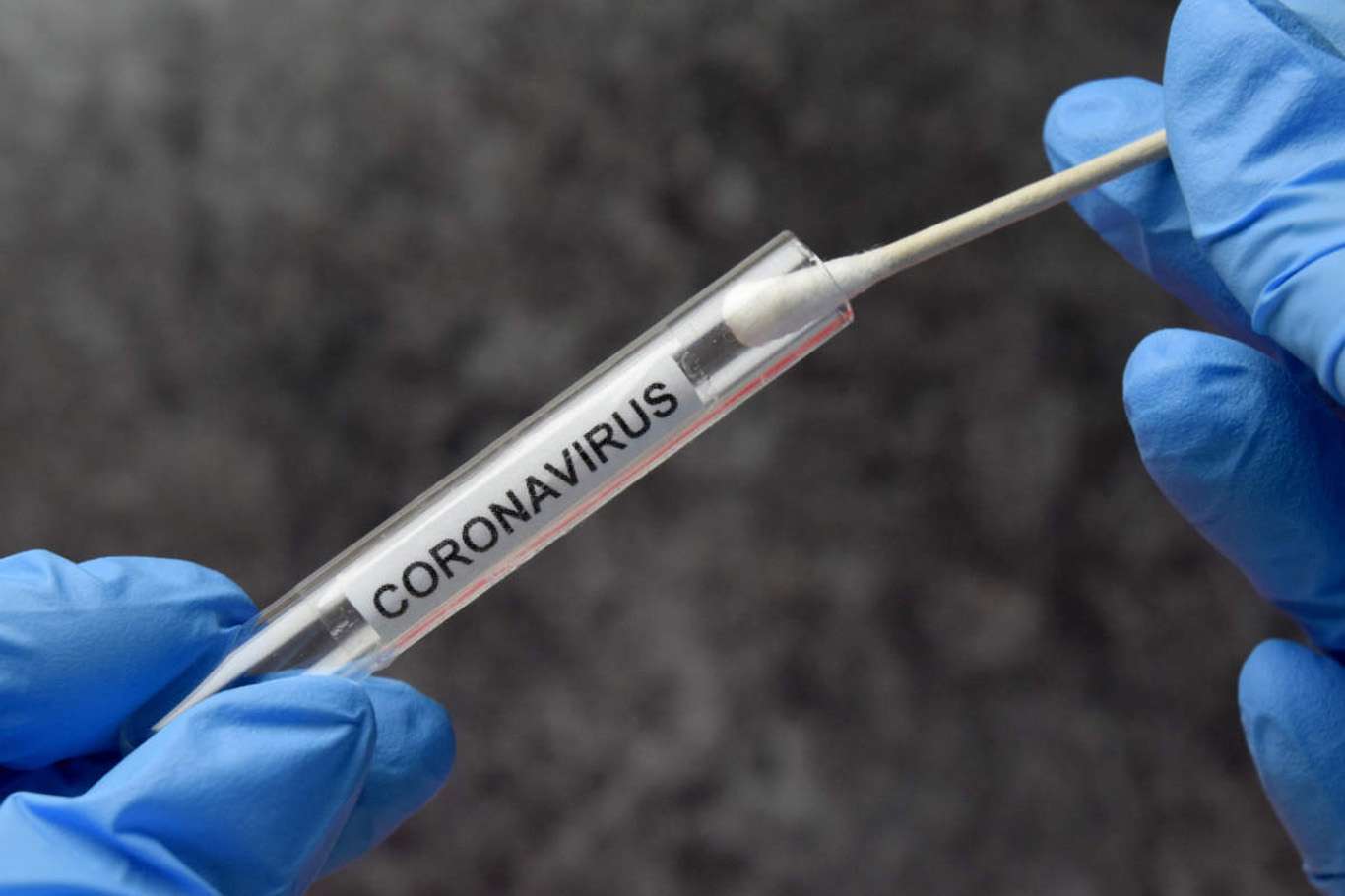 Turkey's confirmed coronavirus cases rise by 54,740